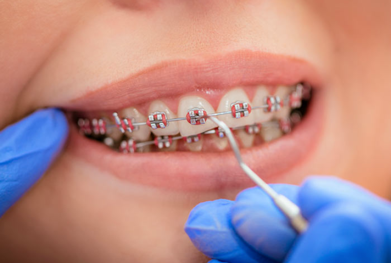 دکتر ارتودنسی ثابت در اصفهان