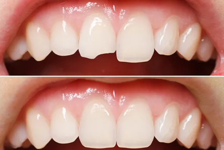 دکتر ترمیم دندان در مشهد