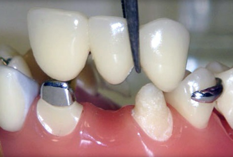 دکتر پونتیک دندان در تبریز